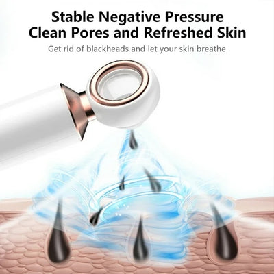 ClearView™ - Pore Vacuum with Magnifying Lens
