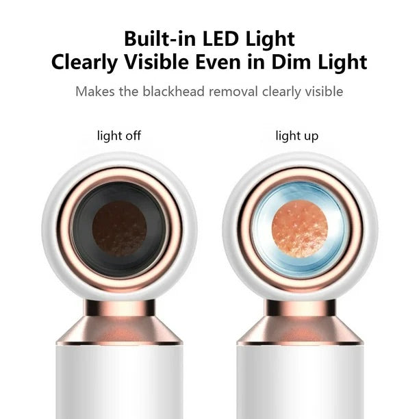 ClearView™ magnifying lens glowing LED - demonstrating real-time visibility during pore vacuuming